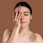 Leia mais sobre o artigo Quais os Tipos de Manchas na Pele e os Sinais de Perigo a Saúde